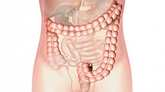 Cancers colorectaux : caractéristiques anatomocliniques & facteurs histo-pronostiques