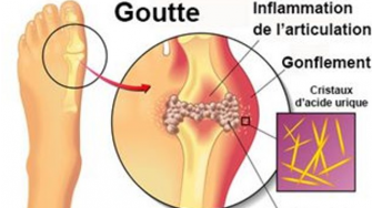 La goutte