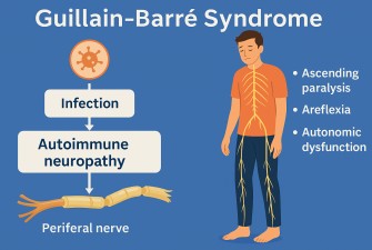 Syndrome de Guillain-Barr&eacute;