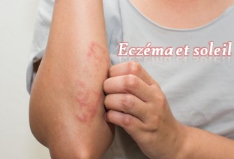 Eczéma et soleil