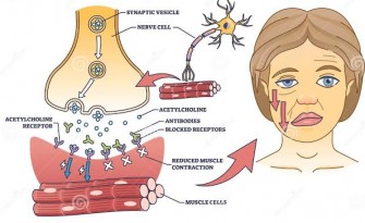 Myasth&eacute;nie auto-immune