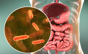 Infections à Escherichia coli