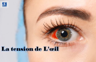 La tension de loeil