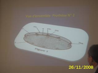 Le Pr. BENELOUEZANE exposant son projet : Atelier d’évaluation d’un prototype de prothèse de réparation des désunions d’anastomoses digestives.