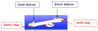 Dialyseur  ou rein artificiel