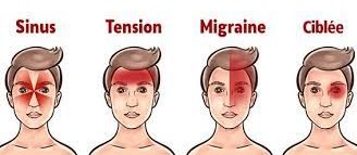 Céphalée de tension: psychogène